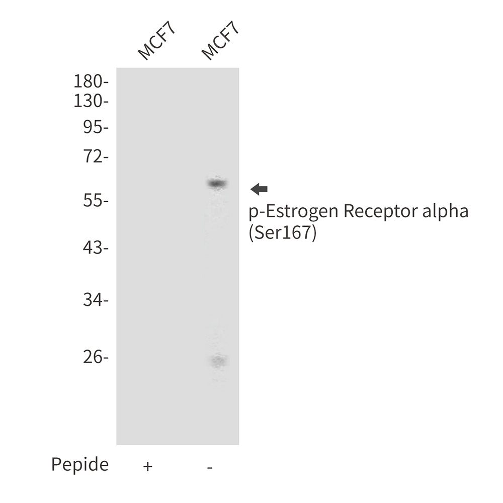 Phospho-Estrogen Receptor alpha (Ser167) Rabbit Polyclonal Antibody
