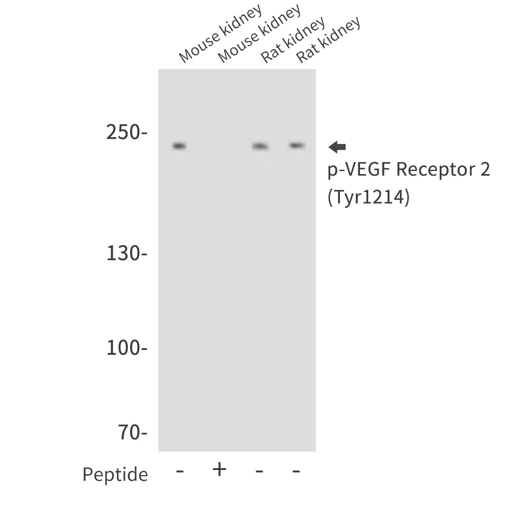 Phospho-VEGF Receptor 2 (Tyr1214) Rabbit Polyclonal Antibody