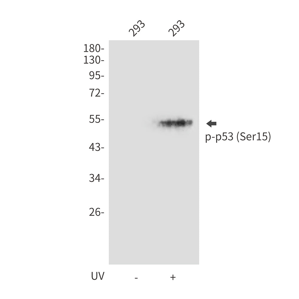 Phospho-p53 (Ser15) Rabbit Polyclonal Antibody