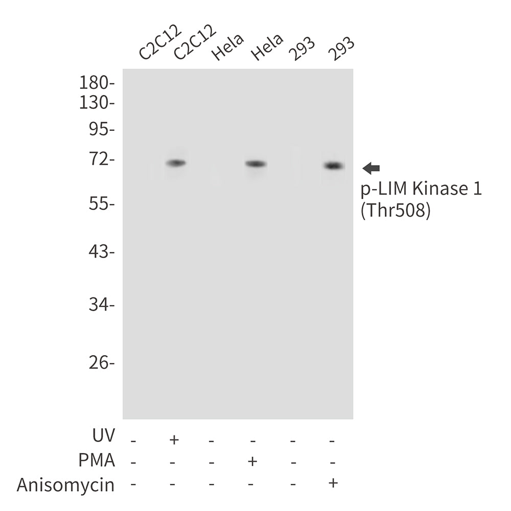 Phospho-LIM Kinase 1 (Thr508) Rabbit Polyclonal Antibody