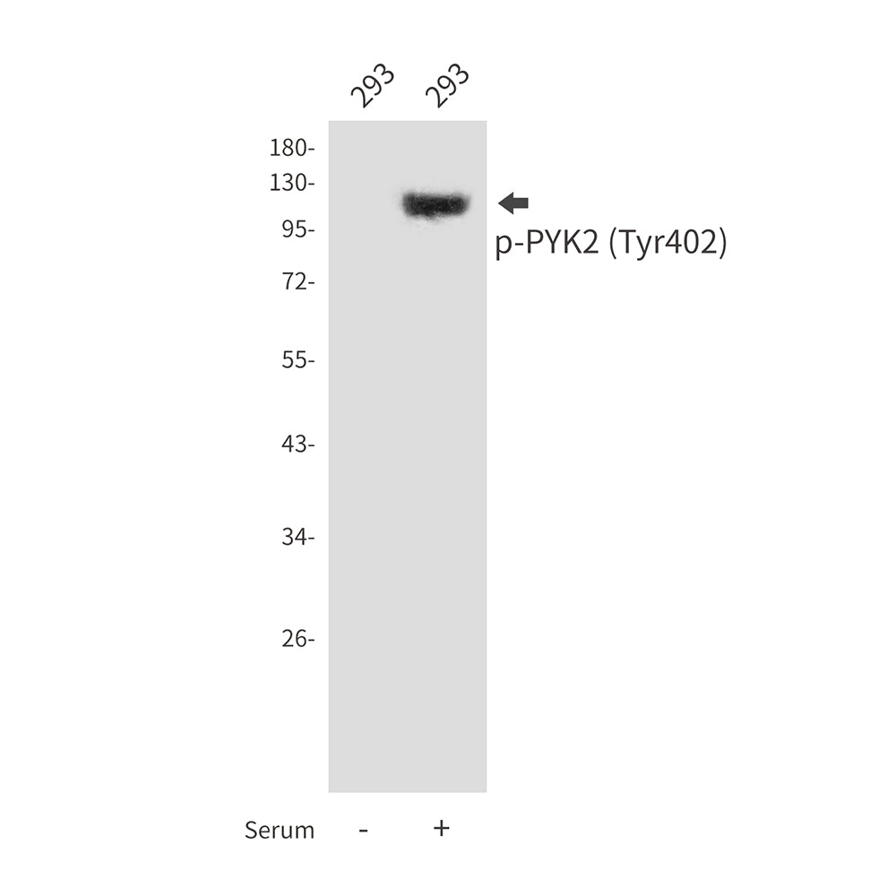 Phospho-PYK2 (Tyr402) Rabbit Polyclonal Antibody