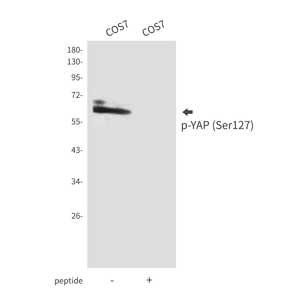 Phospho-YAP (Ser127) Rabbit Polyclonal Antibody