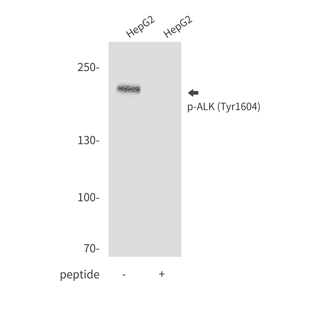Phospho-ALK (Tyr1604) Rabbit Polyclonal Antibody