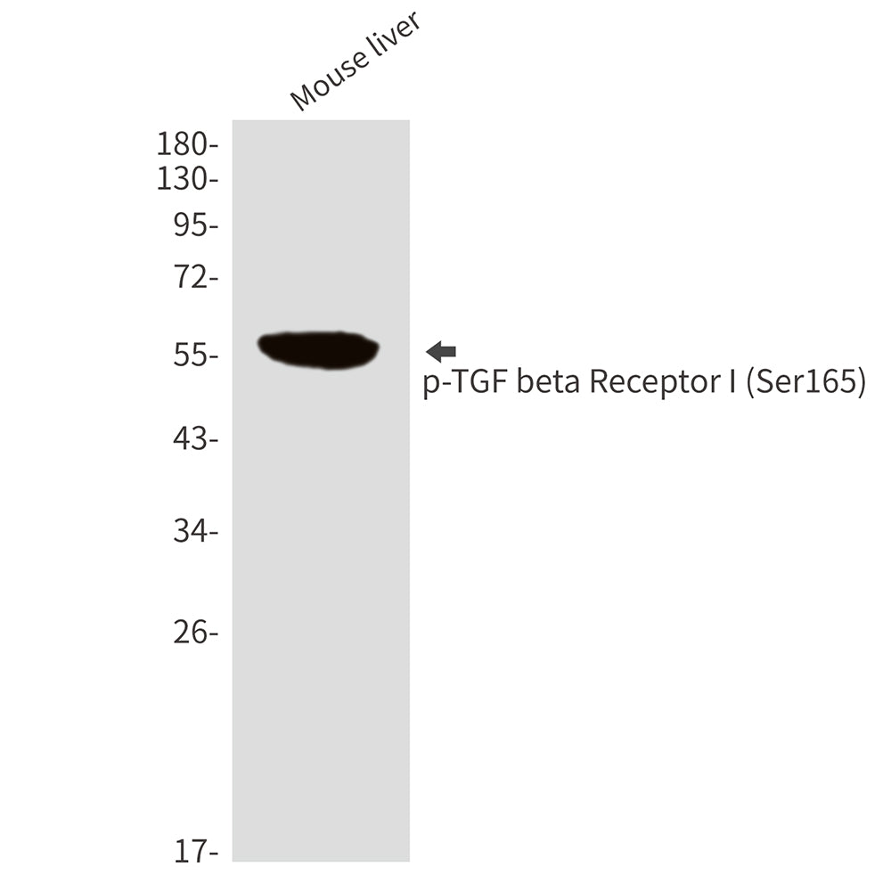 Phospho-TGF beta Receptor I (Ser165) Rabbit Polyclonal Antibody