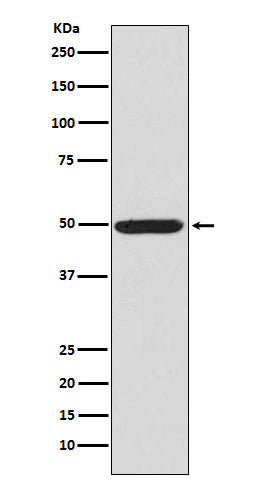 Phospho-PKA RII alpha (Ser99) Rabbit Polyclonal Antibody