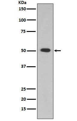 ALDH1A1 Rabbit Polyclonal Antibody