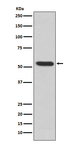 MMP3 Rabbit Polyclonal Antibody