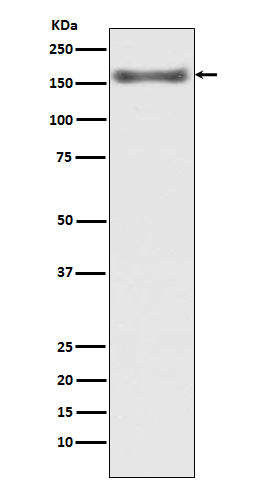 ASK1 Rabbit Polyclonal Antibody
