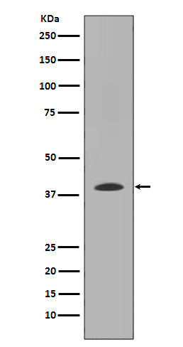 MMP12 Rabbit Polyclonal Antibody