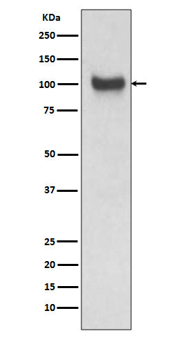 VCAM1 Rabbit Polyclonal Antibody