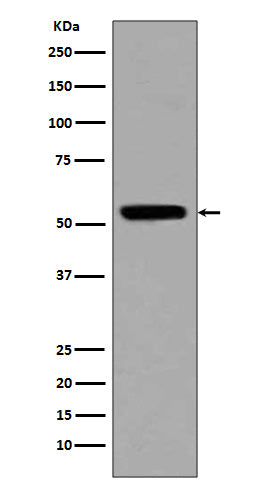 Acetyl-p53 (Lys370) Rabbit Polyclonal Antibody