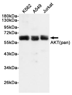 AKT Rabbit Polyclonal Antibody