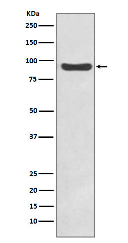 IKK beta Rabbit Polyclonal Antibody