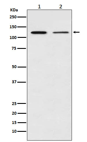NF-KB p100 Rabbit Polyclonal Antibody