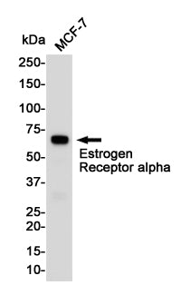 Estrogen Receptor alpha Rabbit Polyclonal Antibody