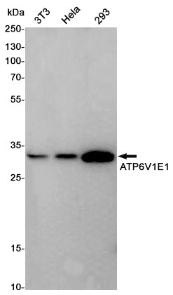 ATP6V1E1 Rabbit Polyclonal Antibody