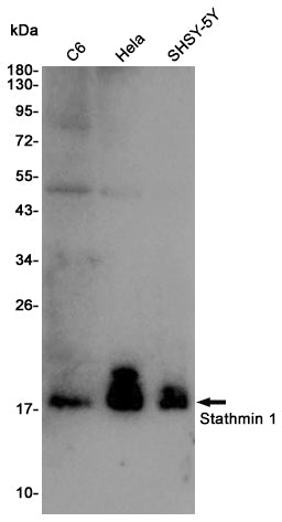 Stathmin 1 Rabbit Polyclonal Antibody