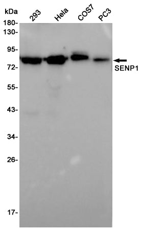 SENP1 Rabbit Polyclonal Antibody