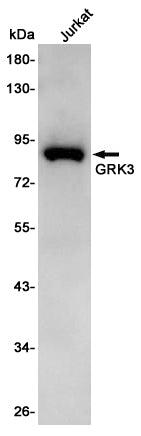GRK3 Rabbit Polyclonal Antibody