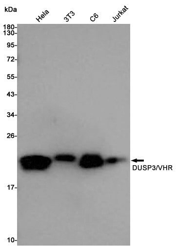 DUSP3 Rabbit Polyclonal Antibody
