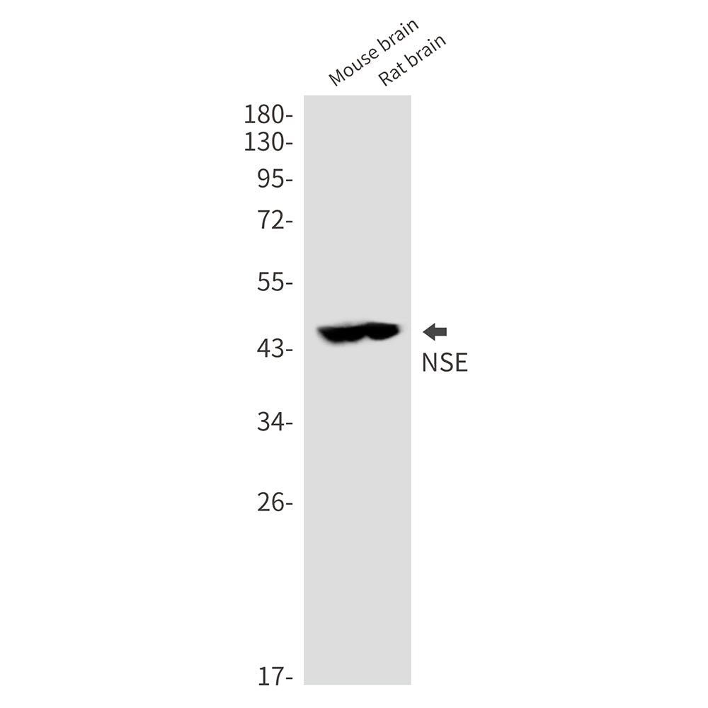 NSE Rabbit Polyclonal Antibody