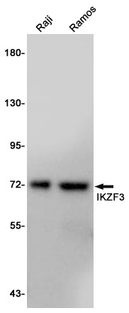IKZF3 Rabbit Polyclonal Antibody