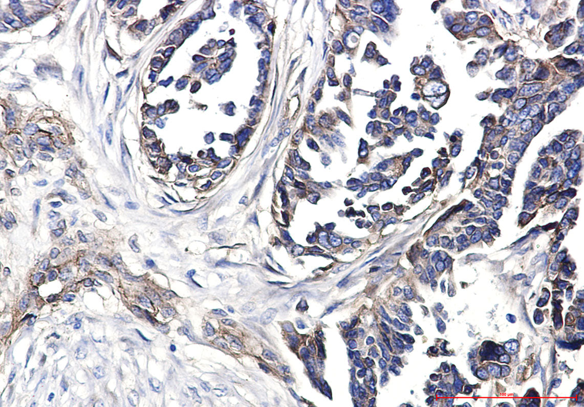Integrin beta 1 Rabbit Polyclonal Antibody