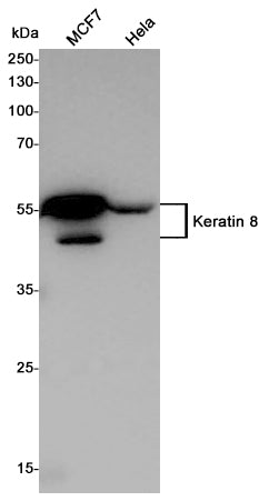 Cytokeratin 8 Rabbit Polyclonal Antibody