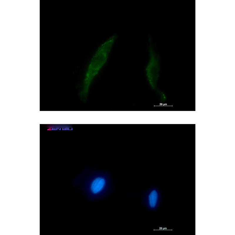 Smad2/3 Rabbit Polyclonal Antibody