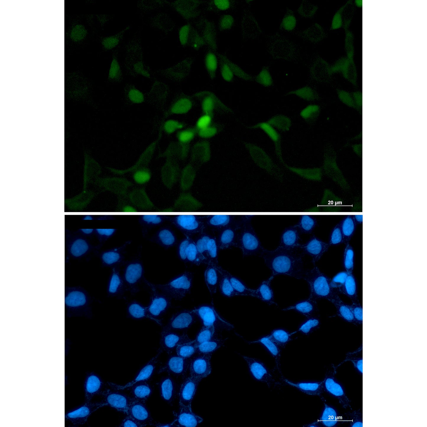 CDT1 Rabbit Polyclonal Antibody