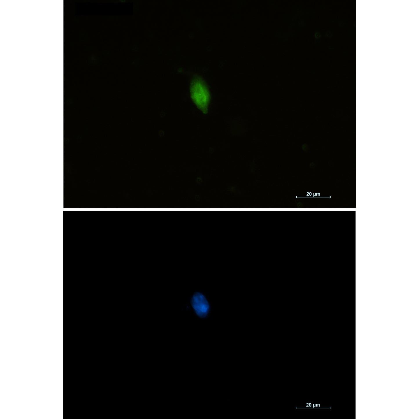 CDKN2A/p16INK4a Rabbit Polyclonal Antibody