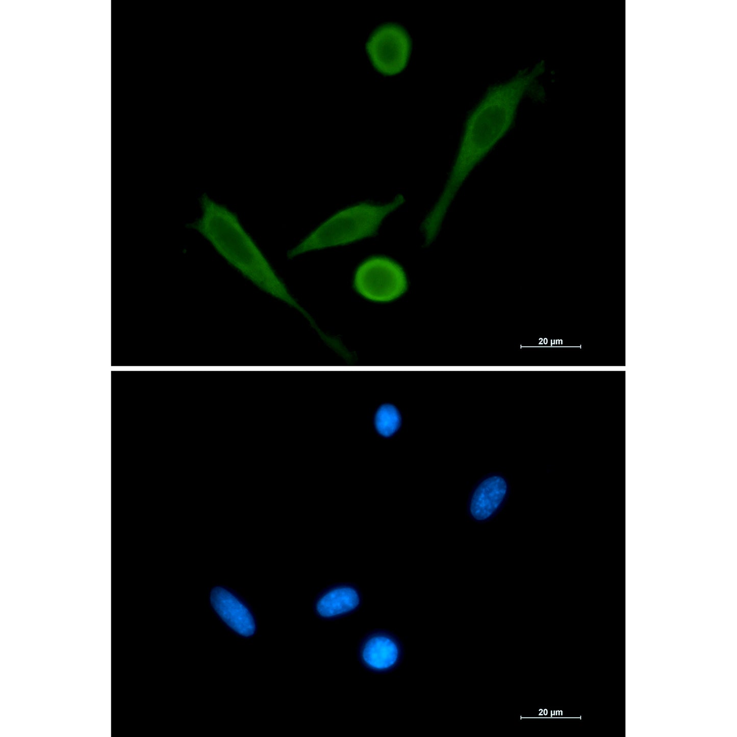Fascin Rabbit Polyclonal Antibody