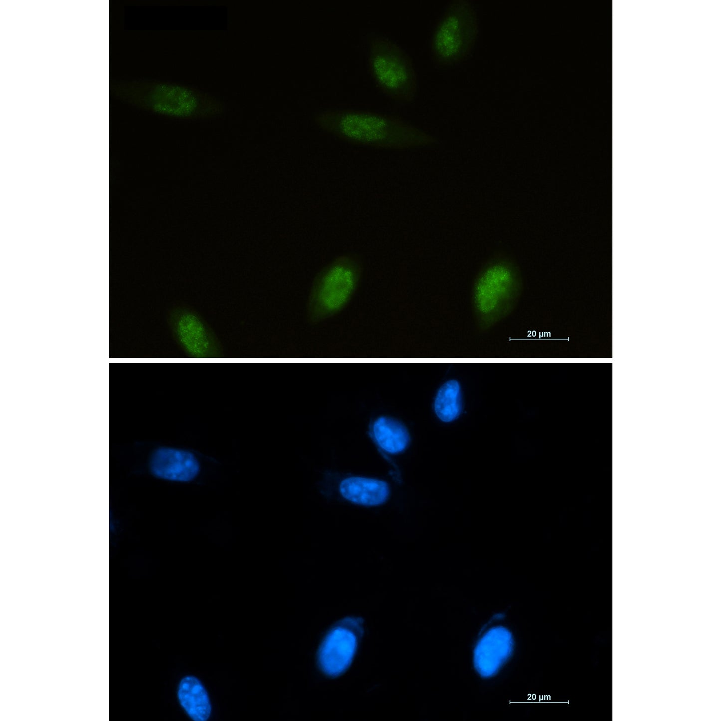 Islet 1 Rabbit Polyclonal Antibody