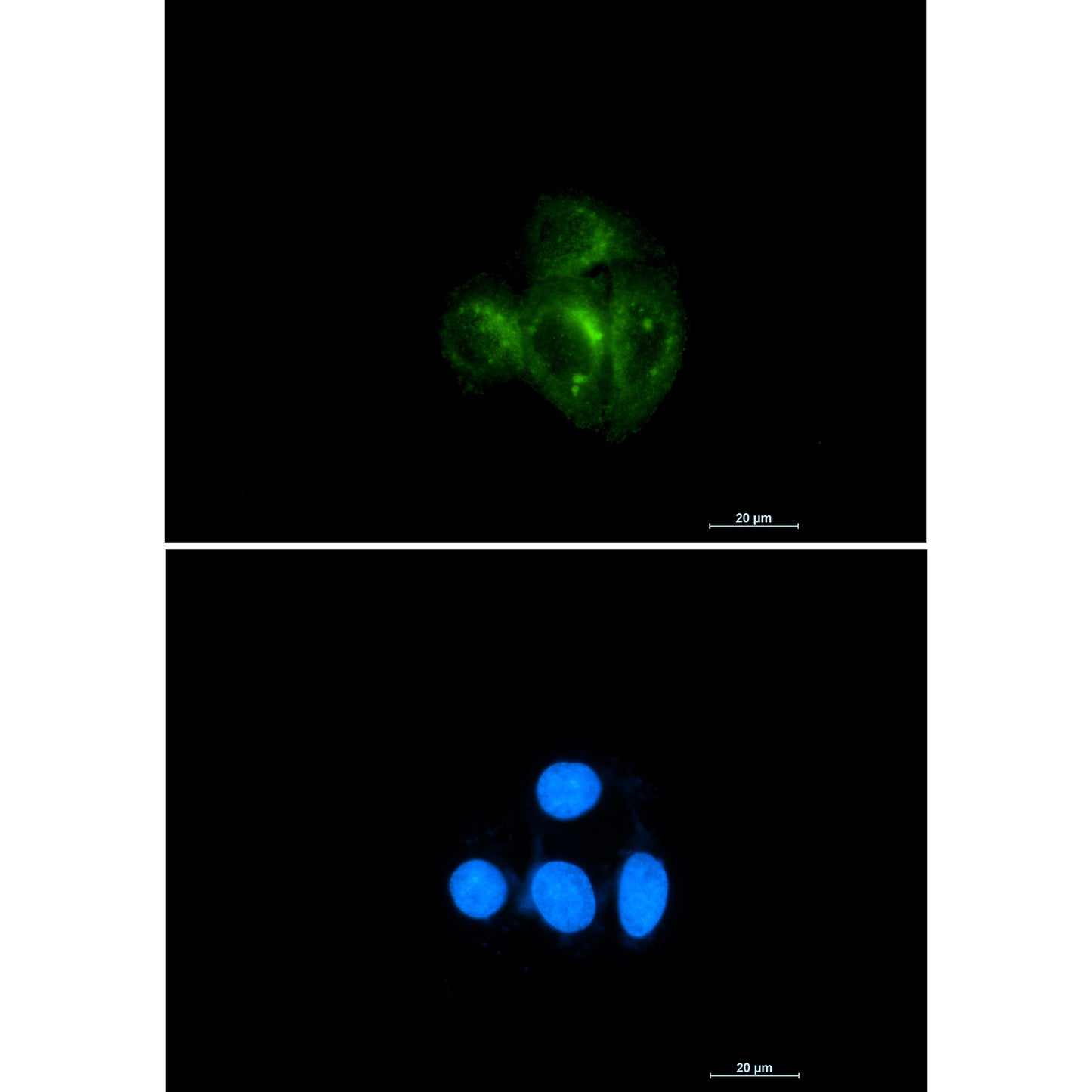 AKT Rabbit Polyclonal Antibody