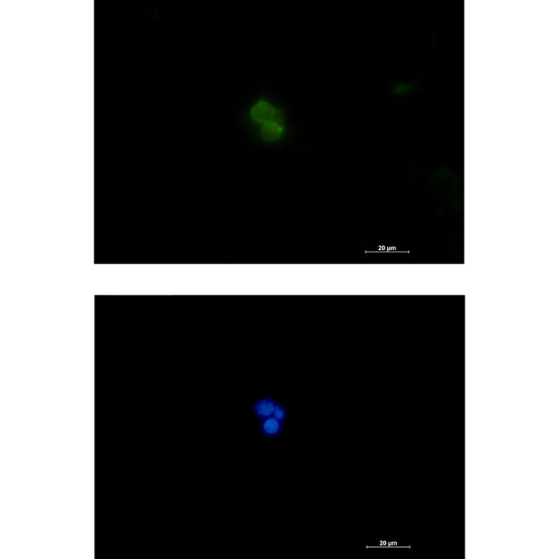 Plastin L Rabbit Polyclonal Antibody
