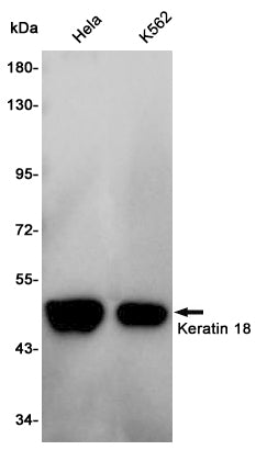 Cytokeratin 18 Rabbit Polyclonal Antibody