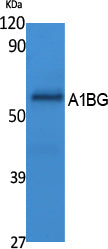 A1BG Rabbit Polyclonal Antibody