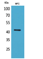 ACTC1 Rabbit Polyclonal Antibody