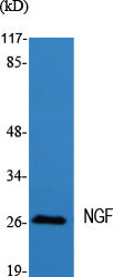 NGF Rabbit Polyclonal Antibody