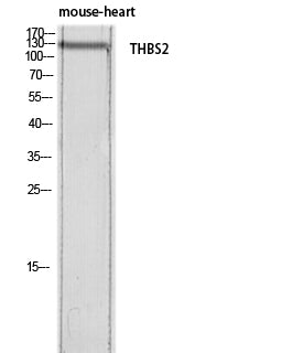 Thrombospondin 2 Rabbit Polyclonal Antibody