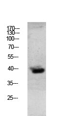 Granzyme B Rabbit Polyclonal Antibody