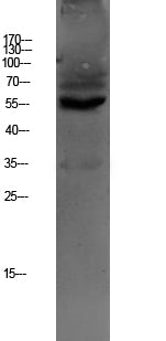 OAT1 Rabbit Polyclonal Antibody