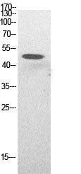 Acetyl-p53 (Lys382) Rabbit Polyclonal Antibody