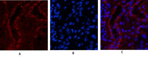 ER beta Rabbit Polyclonal Antibody