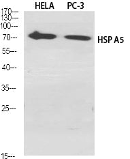 GRP78 BiP Rabbit Polyclonal Antibody