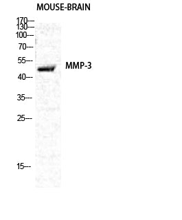 MMP3 Rabbit Polyclonal Antibody