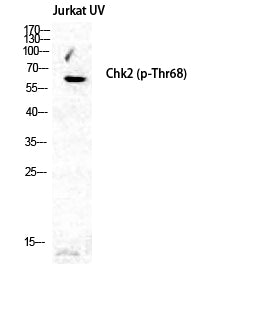 Phospho-Chk2 (Thr68) Rabbit Polyclonal Antibody