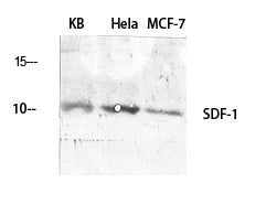 SDF1 Rabbit Polyclonal Antibody