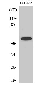 Phospho-AKT (Thr308) Rabbit Polyclonal Antibody