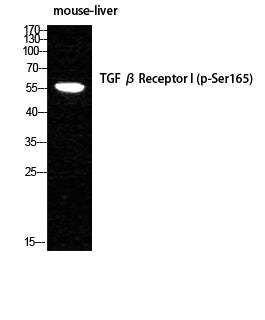 Phospho-TGF beta Receptor I (Ser165) Rabbit Polyclonal Antibody
